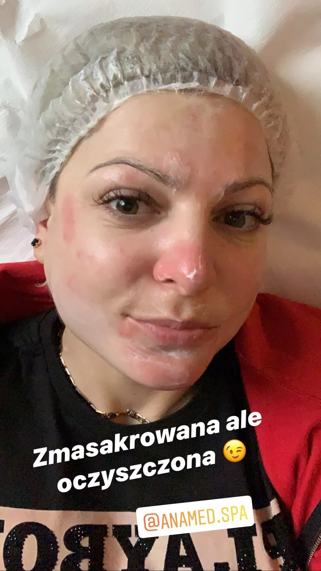 Magda Narożna miała wypadek? Zmasakrowana twarz wokalistki disco polo spędza fanom sen z powiek!